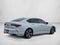 2021 Acura TLX Advance Package